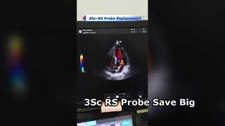 3Sc-RS compatible probe