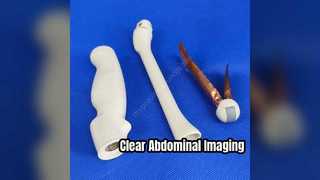 Convex Ultrasound Probe C1-5 Imaging
